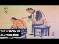 How did Acupuncture become so popular?