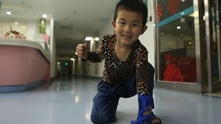 Heart-warming moment six-year-old boy is given a 3D printed hand as Children's Day gift