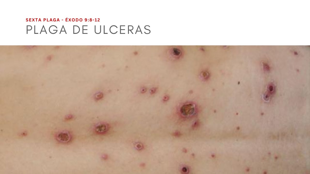 Las 10 cortes de Egipto - 6ª corte: Los espíritus de muerte y enfermedad