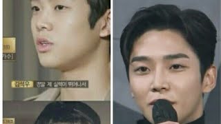 ROWOON SF9 PLASTIC SURGERY