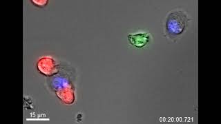 Células STAb T y mieloma. Microscopía confocal