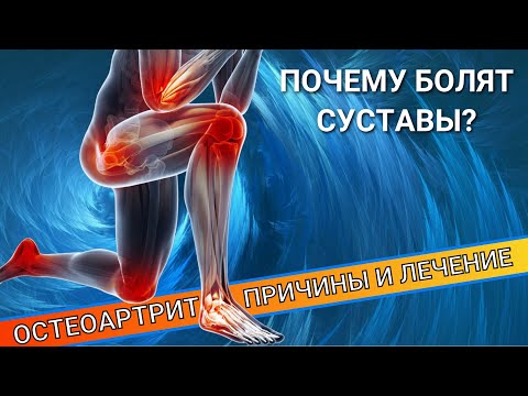 Видео: БОЛЯТ СУСТАВЫ И ПОЯСНИЦА. ОСТЕОАРТРИТ.