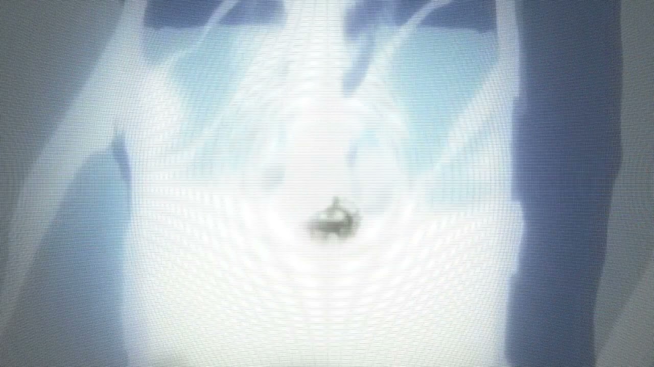 Naruto Edit