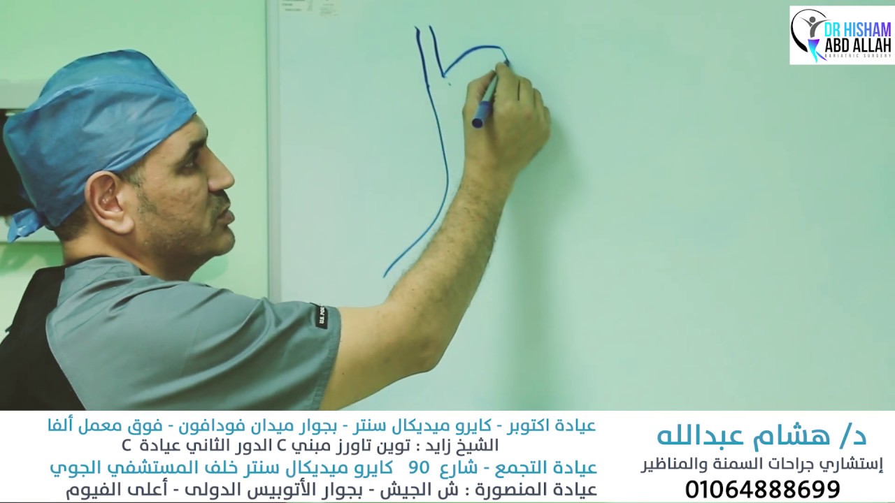 اصلاح عملية تدبيس المعدة بعد فشلها  مع ا.د #هشام_عبدالله