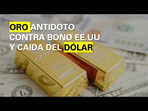 The fall in gold and its connection with the US Bond and the dollar.