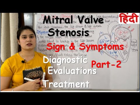 Video: Mitral Stenos - Symtom, Grader, Behandling