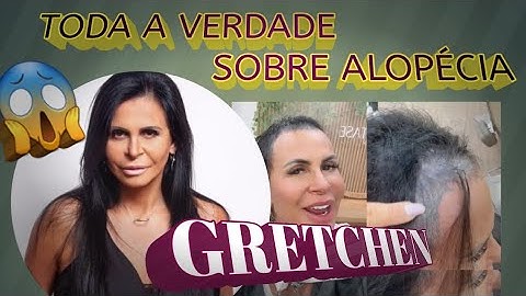#Gretchen perdeu muito cabelo/ #Alopécia / Gretchen explicou tudo que aconteceu com seu cabelo