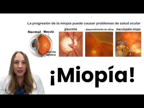 ¡Miopía! ¿Por qué es peligrosa y cómo controlar la progresión de la miopía?