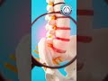 Types of Disc Disease A Comprehensive Guide for Better Spinal Health