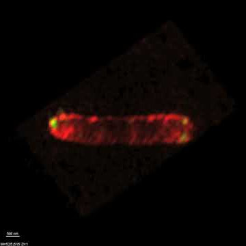 Live E. coli expressing GFP-CheW