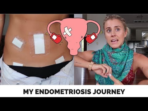 ENDOMETRIOSIS | Symptoms, Surgery and what now? Ashley Freeman