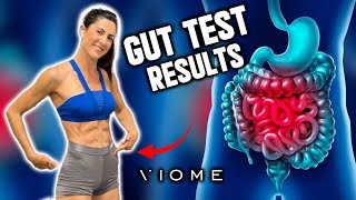 Gut Test Results from Viome [Which healthy foods will I stop eating?!] | LiveLeanTV