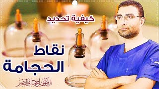 تحديد نقاط الحجامة | Hijama Points 1-55-56-57