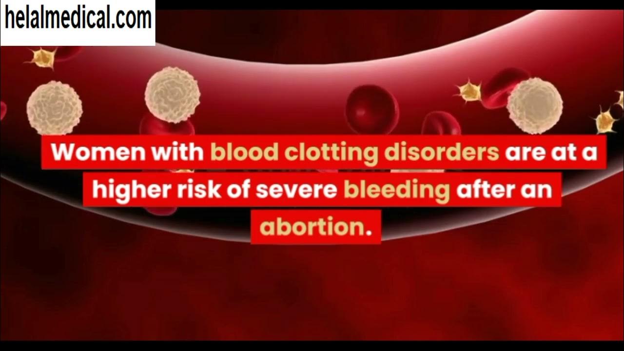 Severe Bleeding after Abortion Causes and Management YouTube