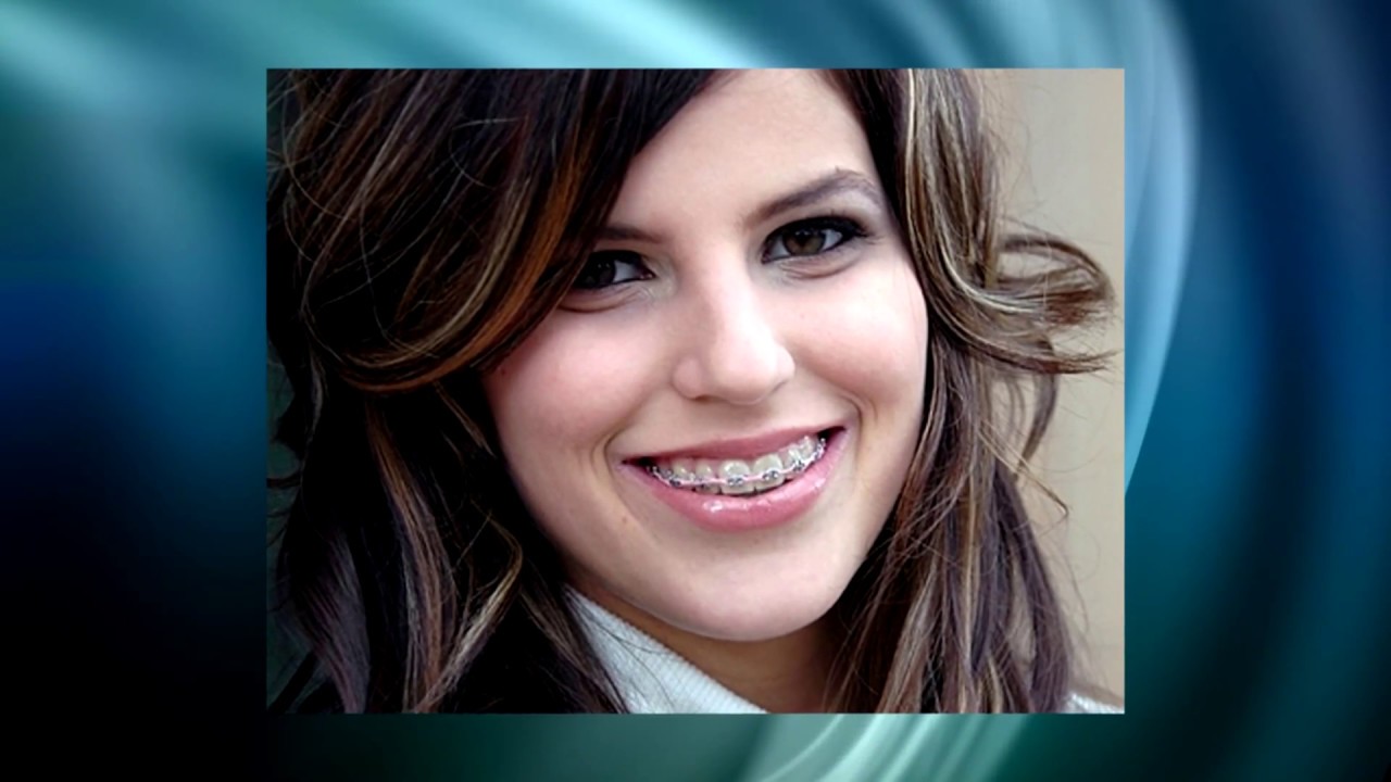 Welcome Video -  Aurora Orthodontics - Dr. Ali Shojaei - Orthodontist