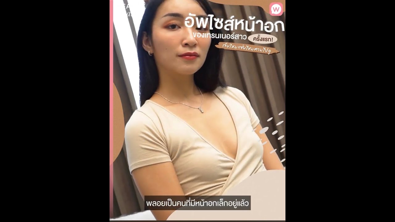 เสริมหน้าอก EP 67 : ซิลิโคน Motiva ergonomix 355 และ 375 CC ร่วมกับการใช้กรวย กับคุณหมอปิติ | ปรับปรุงใหม่นม 350เนื้อหาที่เกี่ยวข้อง