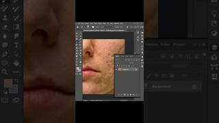 How to remove scars, pimples and patches? Subscribe for more. #photoshop #beauty #creator How to remove scars, pimples and patches? Subscribe for more. #photoshop #beauty #creator