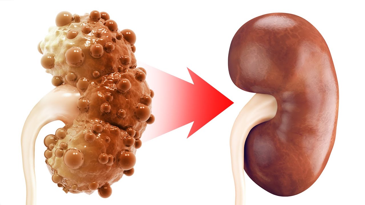 real kidney