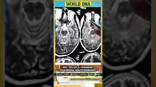 Will you let AI diagnose your mental health problems? | World DNA Shorts