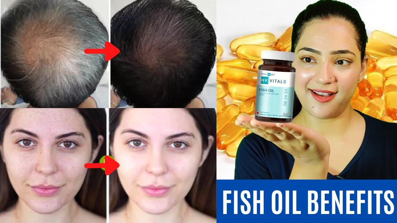 4 Benefits Of Fish Oil For Hair And Skin  Hair And Skin Care Tips  New  Woman