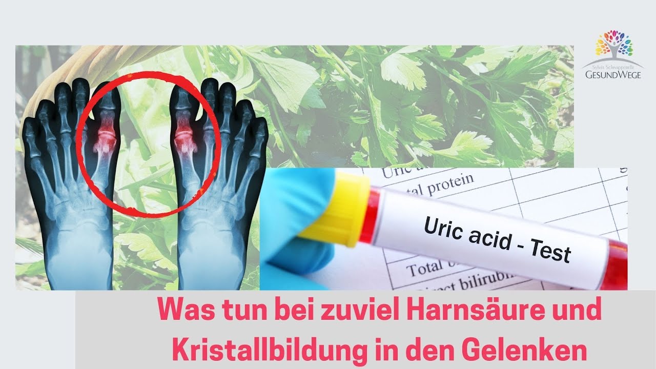 Zu Hohe Harnsäure Was Tun www.youtube.com