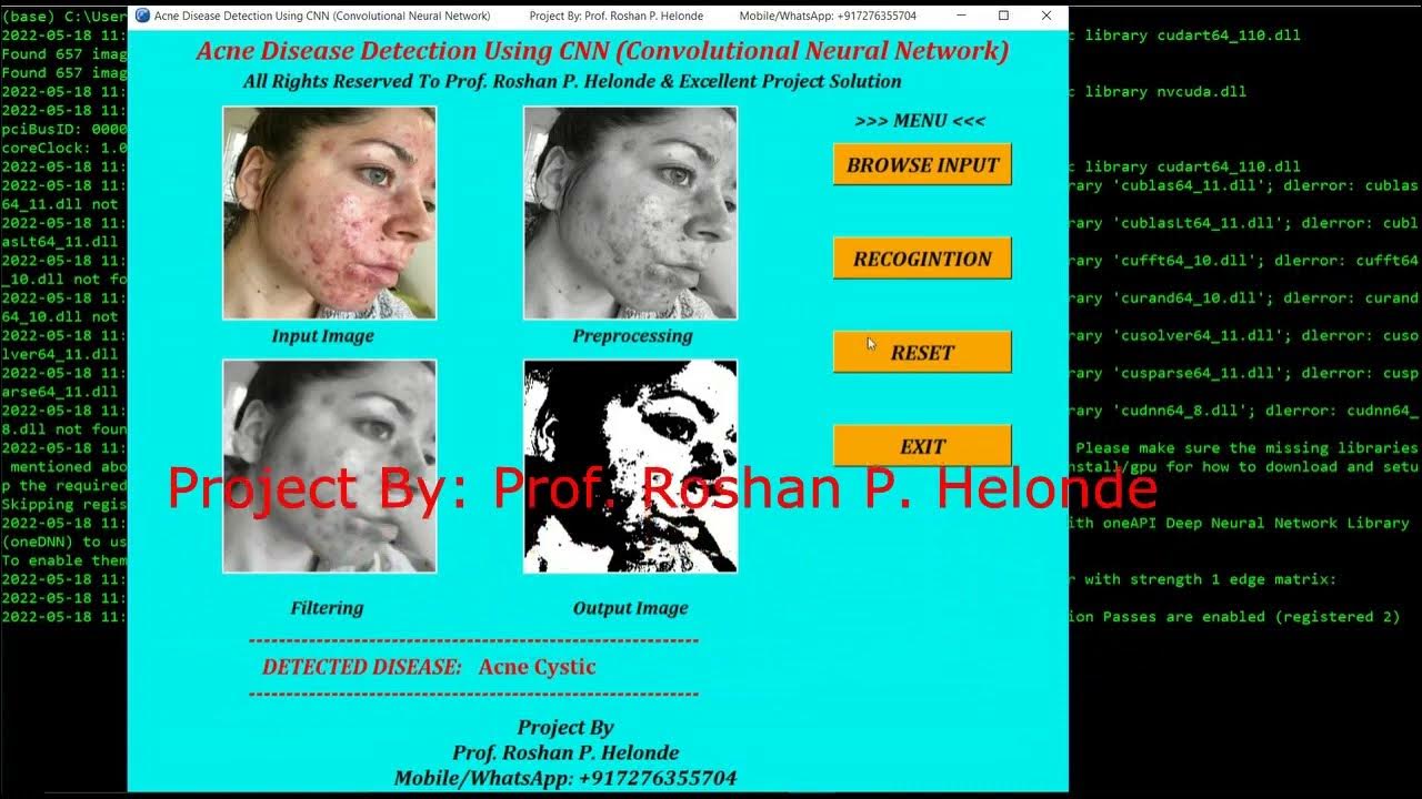 Acne Disease Classification Using Image Processing Python Project With ...