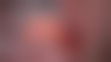 The Fully Digital Implant & Prosthetic Placement by Dr. Isaac D. Tawil