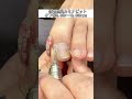 【巻き爪】【マシンケア】フットネイル👣【爪のささり跡】#shorts