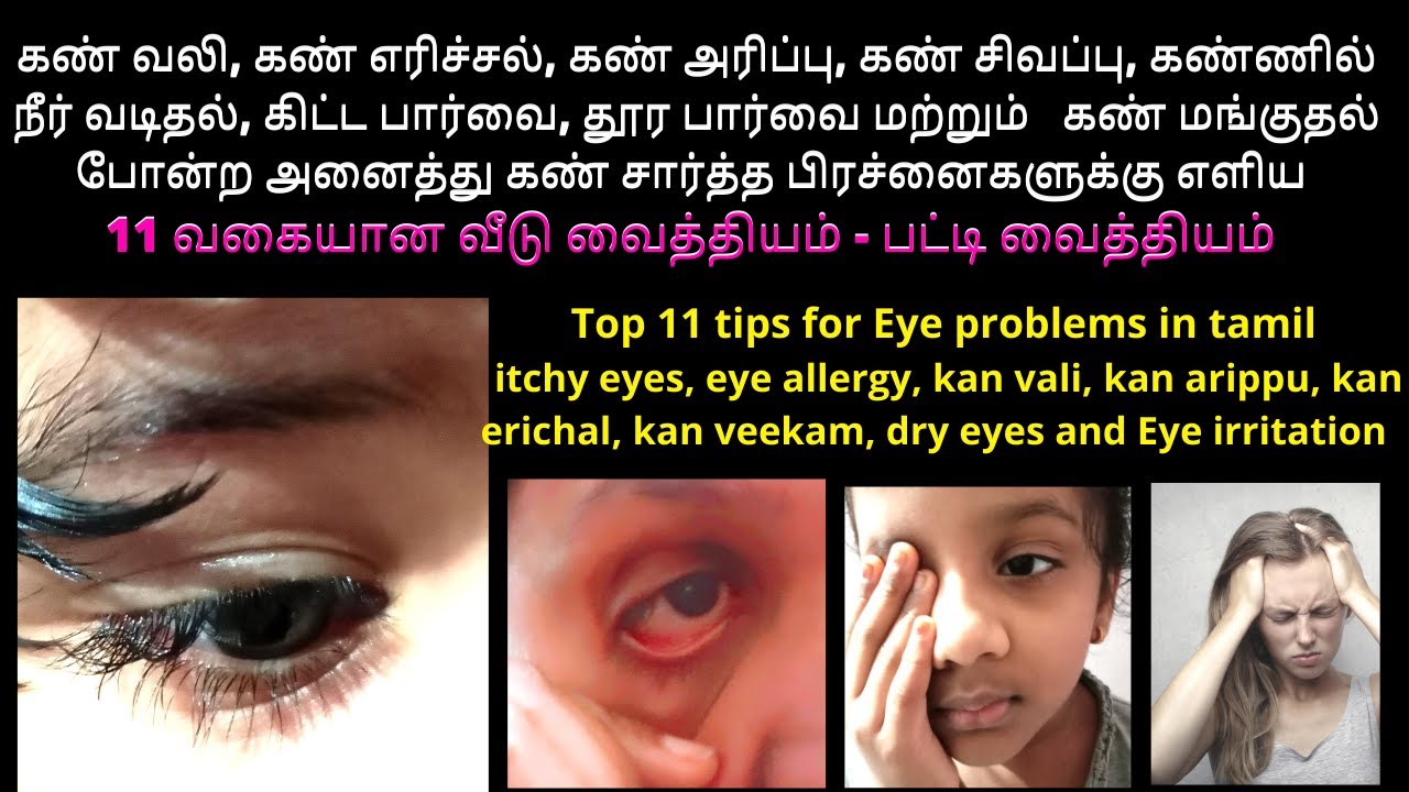 கண் பார்வை குறைபாடு அறிகுறிகள் கண் வலி கண் எரிச்சல் குணமாக Eye