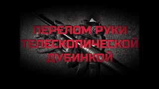Видео Перелом руки телескопической дубинкой. Проект Чистота. (автор: Проект Чистота)