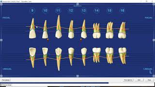 Dentrix Perio Chart Features by Practice Strategies