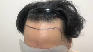 측면콤보 몇모일까요? 쇼쿠모쇼쿠모!!