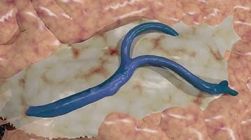 Sylvian Fissure Dissection Animation