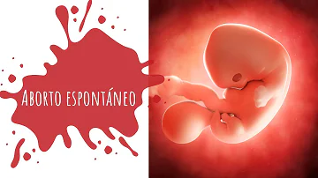 ¿Qué hacer ante la sospecha de un aborto espontáneo prematuro?