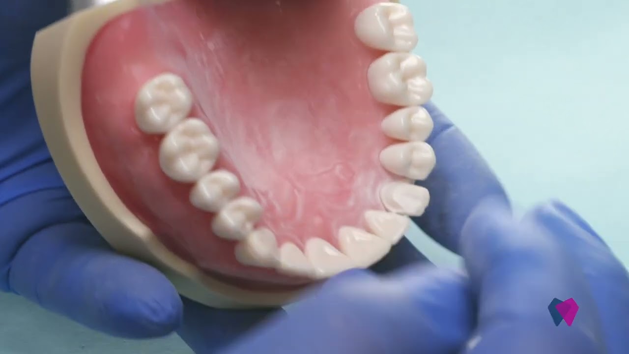 Smooth Margins, Rough Moves: Dr. Goldstein Wraps Up the Crown Prep with 1114.8C Power