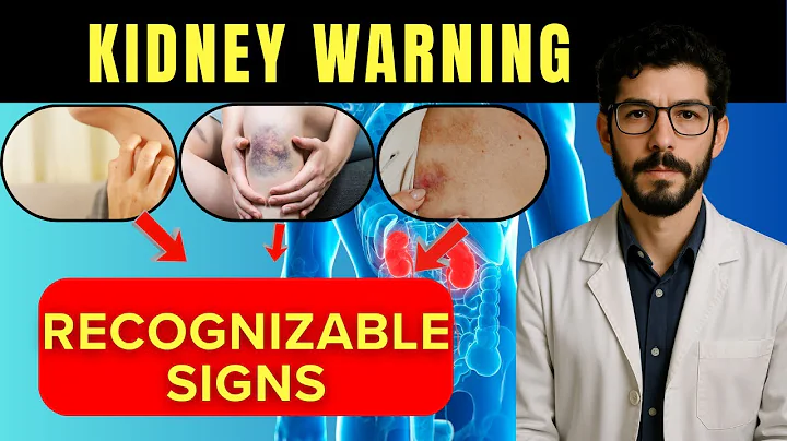 17 Warning Signs of KIDNEY DISEASE You Can Spot Early: Doctor Reveals
