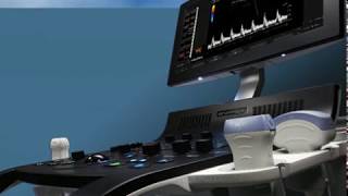 Celebrity Ge Healthcare Versana Essential - Care with Confidence Profile