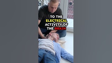 What is an Epileptic Seizure