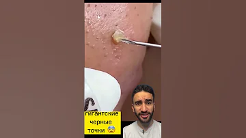 это что гигантские черные точки?