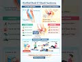घुटने के बाहर दर्द क्यों होता है? IT Band Syndrome. Knee pain/Physiotherapy #Treatment #healthtips