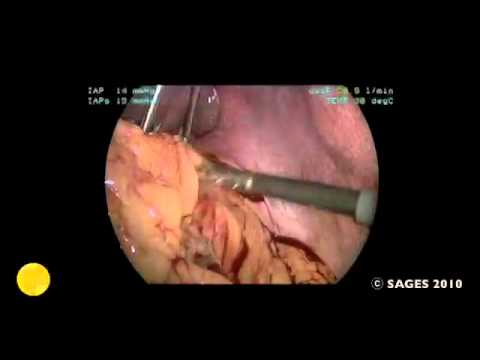 V011 محمد دی سعد DO