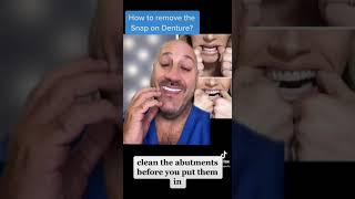 How to remove Snap in Dentures? Unveiling 𝐒𝐧𝐚𝐩-𝐈𝐧 𝐃𝐞𝐧𝐭𝐮𝐫𝐞 𝐑𝐞𝐦𝐨𝐯𝐚𝐥 𝐇𝐚𝐜𝐤𝐬: Expert Advice Cleaning