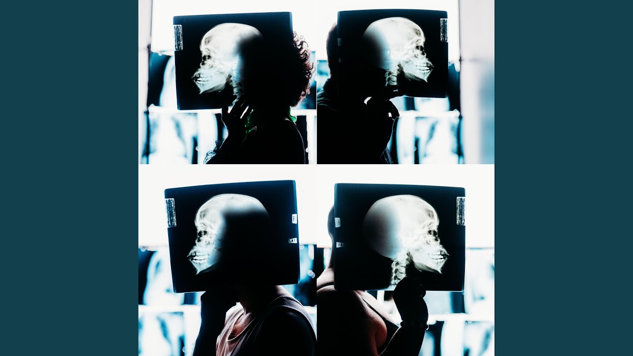 X-Ray adlı videoyu YouTube'da izle X-Ray adlı videoyu YouTube'da izle