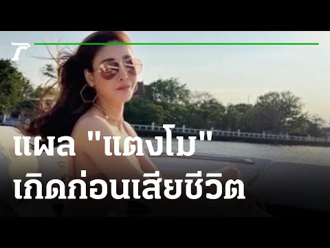 ผลชันสูตรชี้แผล "แตงโม" เกิดก่อนเสียชีวิต | 14-03-65 | ข่าวเช้าหัวเขียว