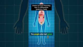 Unlock the Secrets: Cholera vs. Food Poisoning Explained!