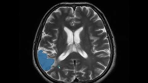 Interactive slice-to-slice CT and MRI segmentation online