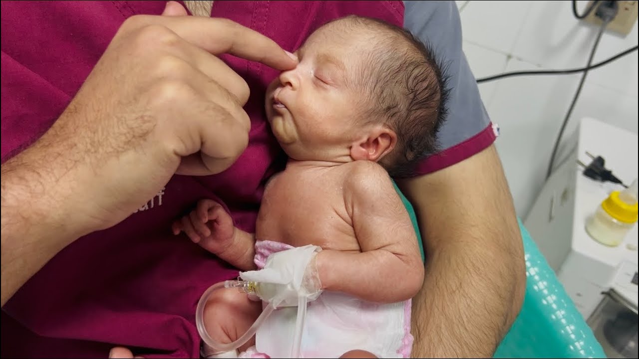 Baby Admitted Again… Still Sharing Cute Feeding Moments🤗💖