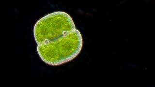 Cosmarium 3D darkfield, Desmid