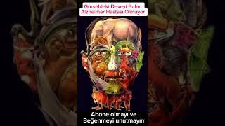 Görseldeki Deveyi Bulan Alzheimer Hastası Olmuyor Alzheimer Testi