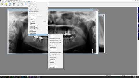Training Video - XrayVision 4: Creating Document Templates
